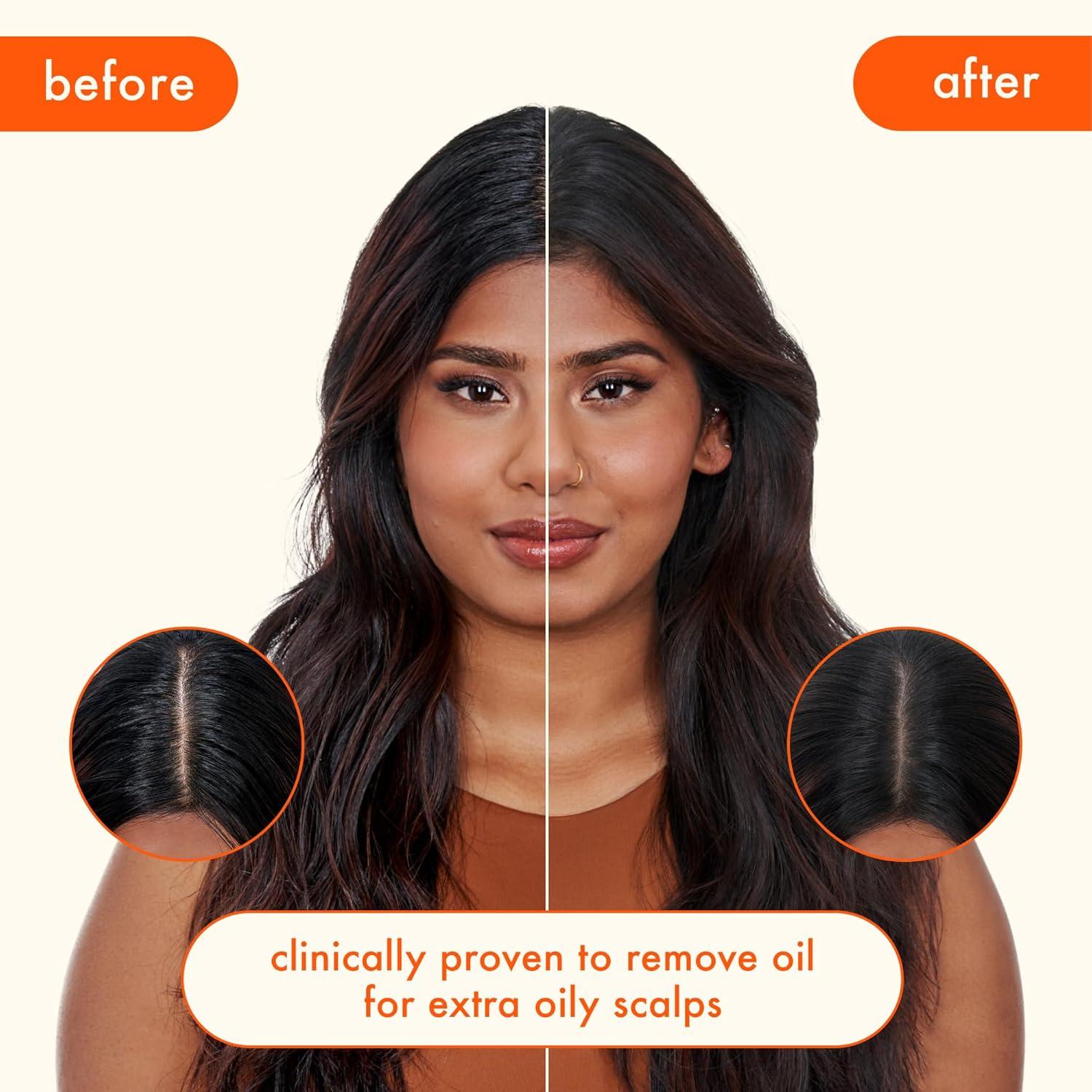 imageamika perk up ultra oil control dry shampoo cleans refreshes scalp roots absorbs helps control oils extends styles between washes for all hair types with extra oily scalps53 Ounce
